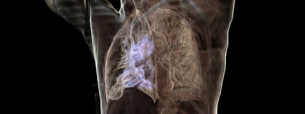 3D medical scans in a (mobile) web browser